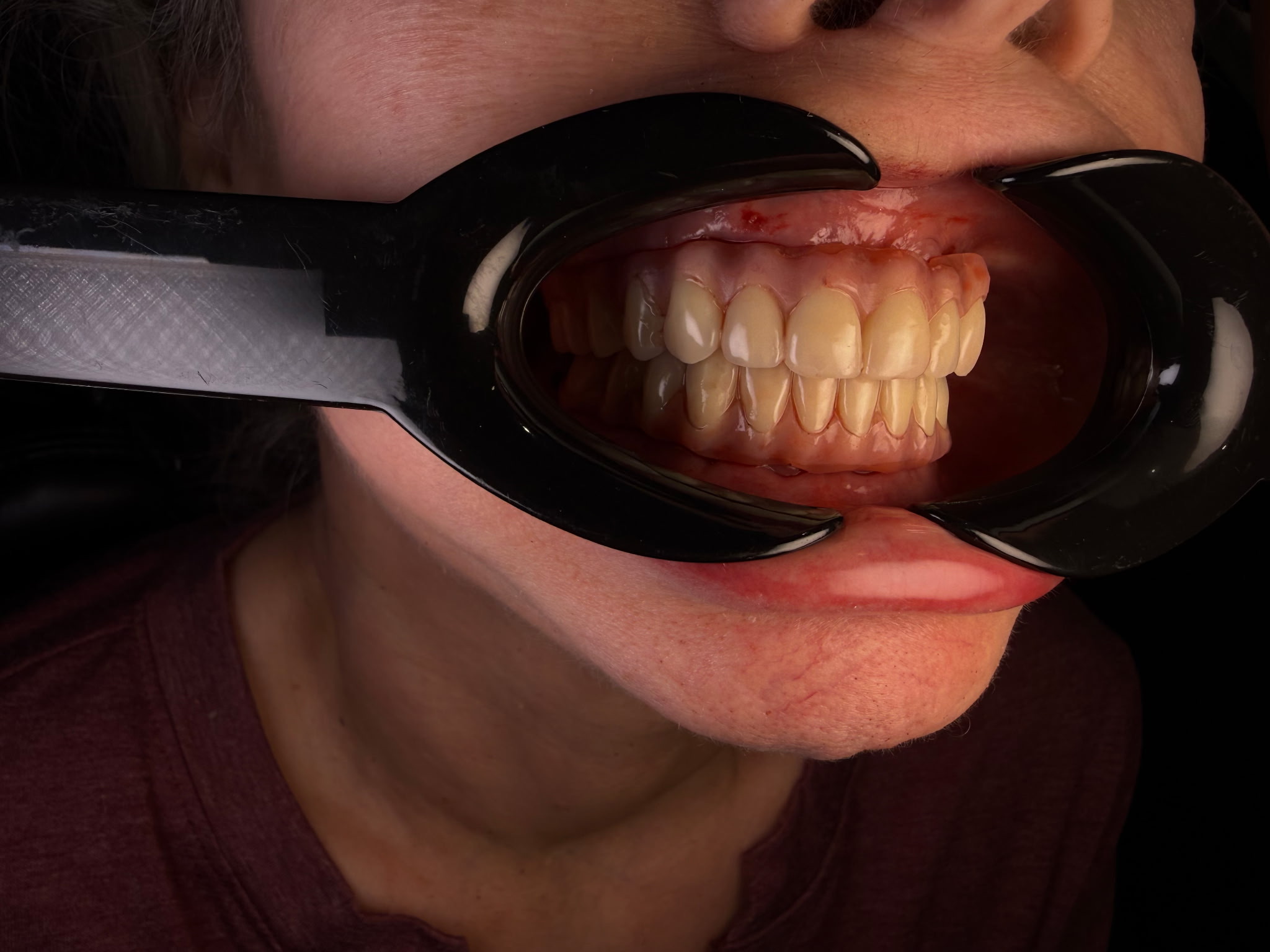 After treatment - view 1