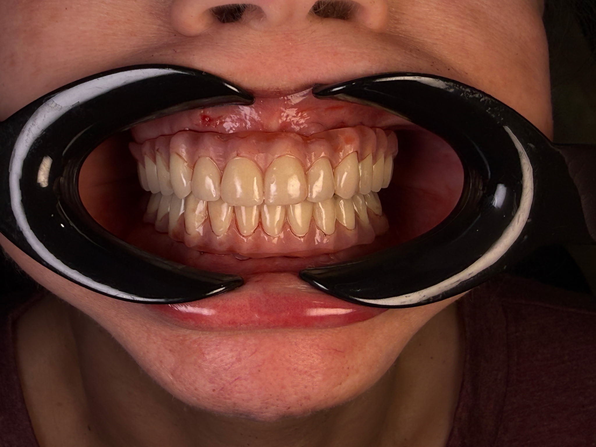 After treatment - view 3