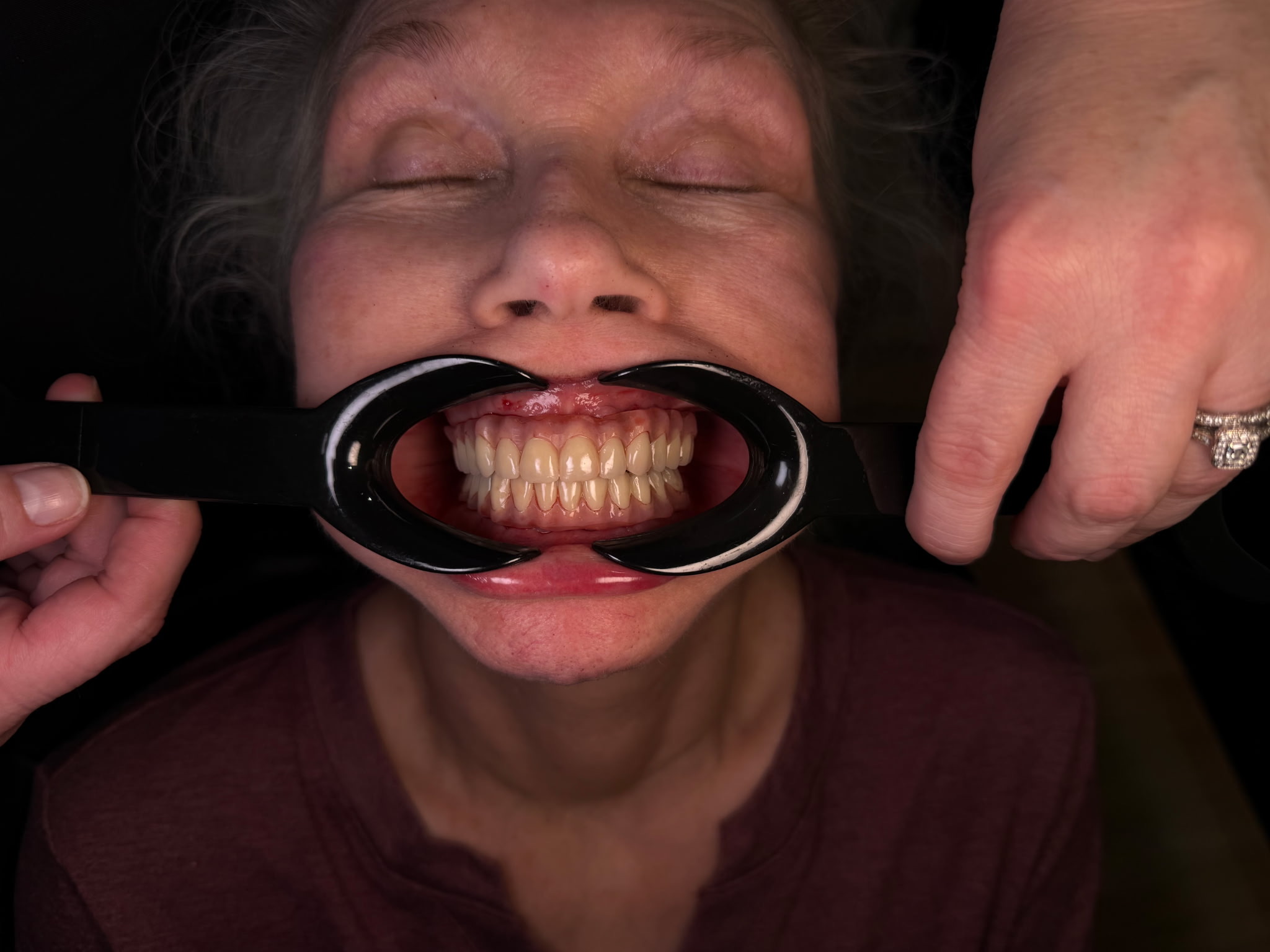 After treatment - view 2