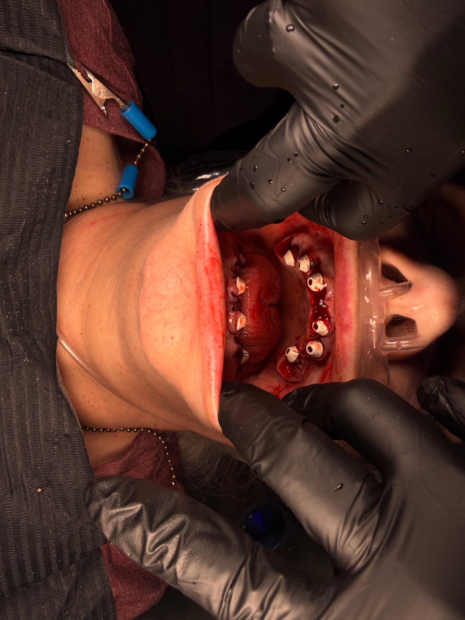 Before treatment - view 1