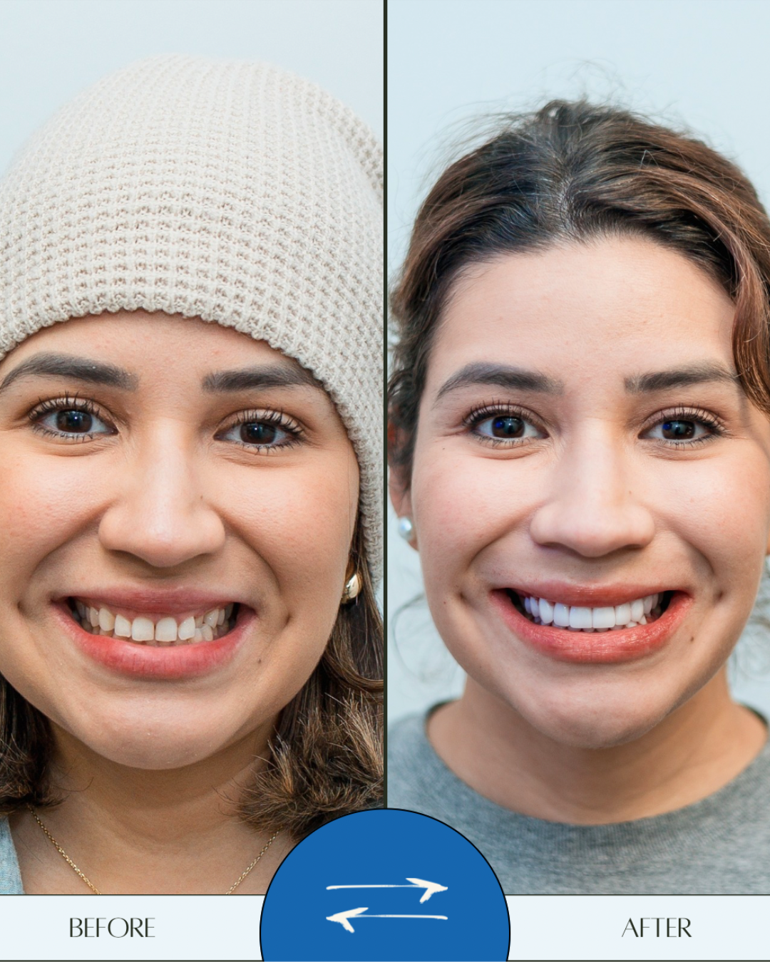 Patient Before & After