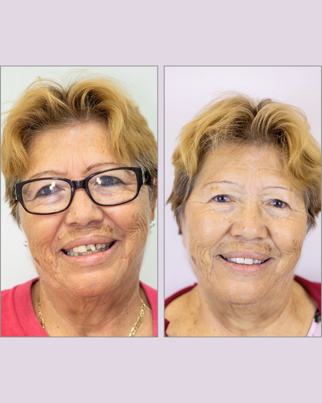 Veronica Before & After